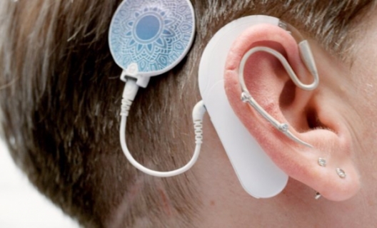 Les mécanismes de l’audition : une ouïe très fine